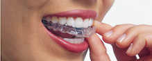 Invisalign in Astoria, NY