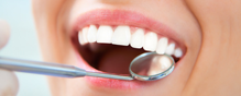 Family Dentist for checkups in Astoria, NY