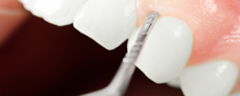 Periodontics in Astoria, NY